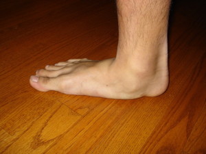 flat foot