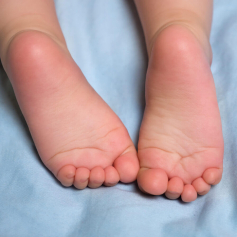 Paediatric Footcare